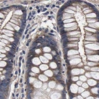 Immunohistochemical staining of human colon using Anti-MARCH7 antibody HPA022152.