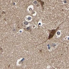 Immunohistochemical staining of human cerebral cortex using Anti-MARCH7 antibody HPA022152.