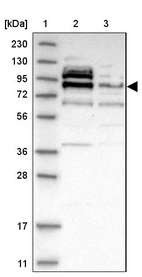 Lane 1: Marker [kDa] 230, 130, 95, 72, 56, 36, 28, 17, 11_br/_Lane 2: Human cell line RT-4_br/_Lane 3: Human cell line U-251MG sp