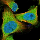 Immunofluorescent staining of human cell line U-251 MG shows localization to plasma membrane & cytosol.