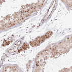 Anti-CHD1 Antibody