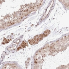 Immunohistochemical staining of human testis shows moderate nuclear positivity in cells in seminiferous ducts.