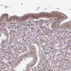 Immunohistochemical staining of human endometrium shows weak to moderate cytoplasmic positivity in glandular cells.