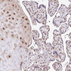 Anti-CHD1 Antibody