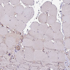 Anti-CHD1 Antibody