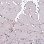 Immunohistochemical staining of human skeletal muscle shows no positivity in myocytes as expected.