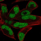 Immunofluorescent staining of human cell line RH-30 shows localization to nucleus & nucleoli fibrillar center.