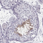 Anti-SPACA9 Antibody