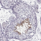Immunohistochemical staining of human testis shows high expression.