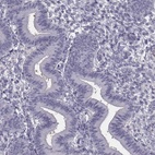 Anti-SPACA9 Antibody