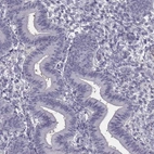 Immunohistochemical staining of human endometrium shows low expression as expected.