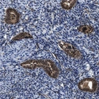 Immunohistochemical staining of human endometrium shows strong nuclear positivity in glandular cells.