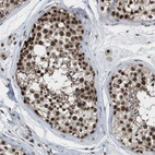 Immunohistochemical staining of human testis shows strong nuclear positivity in cells in seminiferous ducts.