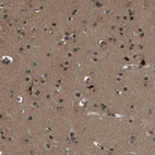 Immunohistochemical staining of human cerebral cortex shows strong nuclear positivity in neurons.