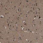 Immunohistochemical staining of human cerebral cortex shows strong nuclear positivity in neurons.