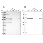 Western blot analysis using Anti-PRPF4 antibody HPA022248 (A) shows similar pattern to independent antibody HPA021794 (B).