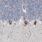 Anti-NYAP1 Antibody