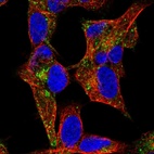 Immunofluorescent staining of human cell line SH-SY5Y shows localization to the Golgi apparatus & vesicles.