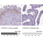 Anti-CYP24A1 Antibody