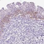 Immunohistochemical staining of human urinary bladder shows strong granular cytoplasmic positivity in urothelial cells.