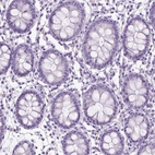 Immunohistochemical staining of human colon shows no positivity in glandular cells as expected.