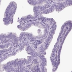 Immunohistochemical staining of human Fallopian tube shows no positivity in glandular cells as expected.