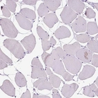 Immunohistochemical staining of human skeletal muscle shows no positivity in myocytes as expected.
