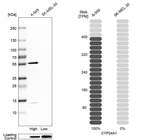 Western blot analysis in human cell lines A-549 and SK-MEL-30 using Anti-CYP24A1 antibody. Corresponding CYP24A1 RNA-seq data are presented for the same cell lines. Loading control: Anti-PARP1.