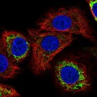 Immunofluorescent staining of human cell line A549 shows localization to mitochondria.