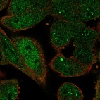 Immunofluorescent staining of human cell line RH-30 shows localization to nucleoplasm, nuclear bodies & cytosol.
