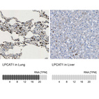 Anti-LPCAT1 Antibody