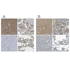 Immunohistochemical staining of human cerebral cortex, kidney, liver and lung using Anti-LPCAT1 antibody HPA022268 (A) shows similar protein distribution across tissues to independent antibody HPA012501 (B).