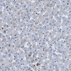 Immunohistochemical staining of human liver shows no positivity in hepatocytes as expected.
