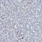 Immunohistochemical staining of human liver shows no positivity in hepatocytes as expected.