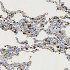 Immunohistochemical staining of human lung shows moderate to strong cytoplasmic positivity in pneumocytes.