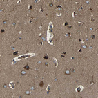 Immunohistochemical staining of human cerebral cortex shows moderate to strong cytoplasmic positivity in neurons.