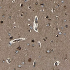 Immunohistochemical staining of human cerebral cortex shows moderate to strong cytoplasmic positivity in neurons.