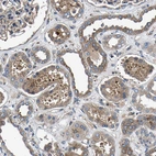 Immunohistochemical staining of human kidney shows weak to moderate cytoplasmic positivity in cells in tubules.