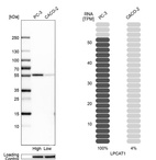 Western blot analysis in human cell lines PC-3 and Caco-2 using Anti-LPCAT1 antibody. Corresponding LPCAT1 RNA-seq data are presented for the same cell lines. Loading control: Anti-HSP90B1.