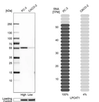 Western blot analysis in human cell lines PC-3 and Caco-2 using Anti-LPCAT1 antibody. Corresponding LPCAT1 RNA-seq data are presented for the same cell lines. Loading control: Anti-HSP90B1.