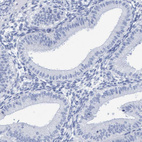 Immunohistochemical staining of human endometrium shows no positivity as expected.