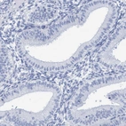 Immunohistochemical staining of human endometrium shows no positivity as expected.