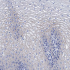 Immunohistochemical staining of human esophagus shows very weak membranous positivity in squamous epithelial cells.