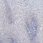 Immunohistochemical staining of human esophagus shows very weak membranous positivity in squamous epithelial cells.