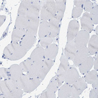 Immunohistochemical staining of human skeletal muscle shows no positivity as expected.