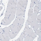 Immunohistochemical staining of human skeletal muscle shows no positivity as expected.