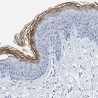 Immunohistochemical staining of human skin shows moderate to strong membranous positivity in stratum corneum.