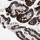 Immunohistochemical staining of human duodenum shows strong cytoplasmic positivity in glandular cells.