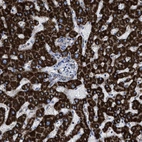Immunohistochemical staining of human liver shows strong cytoplasmic positivity in hepatocytes.