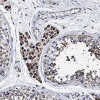 Immunohistochemical staining of human testis shows moderate cytoplasmic positivity in Leydig cells.